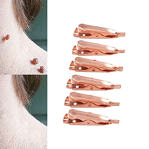 מסיר עור תג קליפים בטוח נחושת חלקה עור תג ההסרה כלי מסיר עור תג המכשיר עור תג ההסרה ערכת עבור הפנים הצוואר לגוף(6pcs)